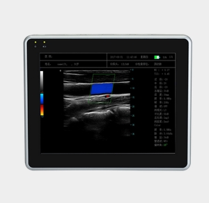 wEye6 威爾德平板式全數(shù)字彩色多普勒超聲診斷系統(tǒng)