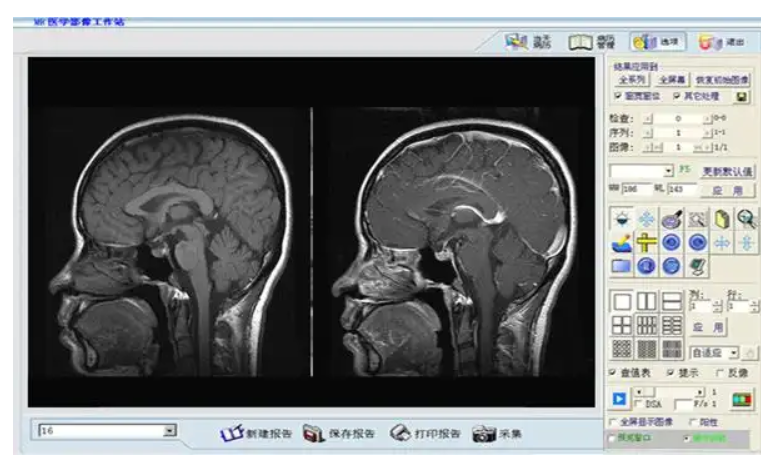 uAI-BrainImaging-MRI 頭部磁共振影像處理軟件