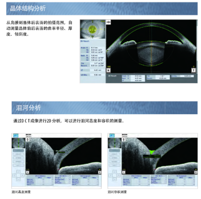 MIAS-2000(1.1) 眼科影像存儲處理與分析系統