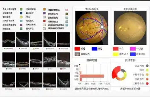 FACT-EYE1.0 眼科影像管理系統