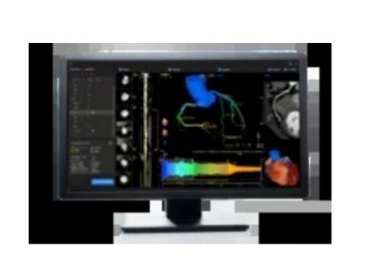 AngioPlus Core 定量血流分?jǐn)?shù)測(cè)量軟件