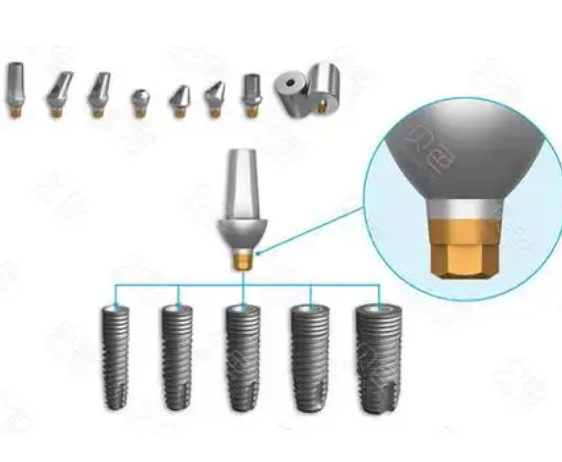 牙種植體基臺及附件 斯邁英圖